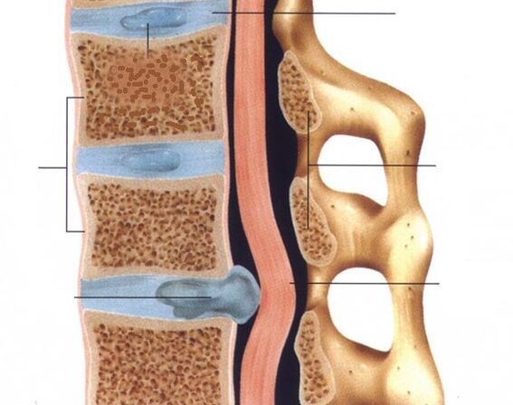 As hernias pronúncianse
