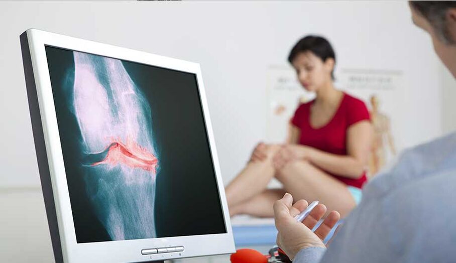 Consulta cun médico se se sospeita de artrite ou artrose