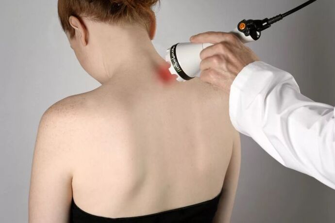 Fisioterapia para osteocondrose