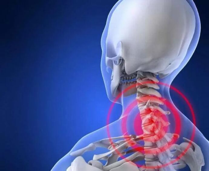 Que é a osteocondrose