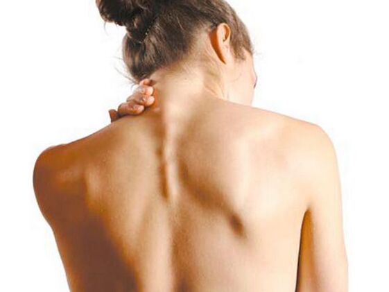 A nena ten osteocondrose cervical