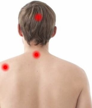 lugar da dor na osteocondrose cervical