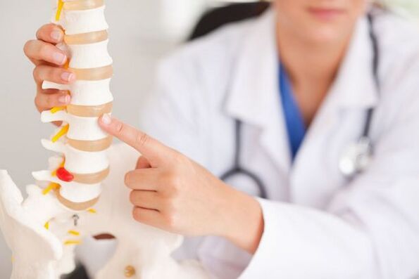 médico demostra un modelo da columna vertebral