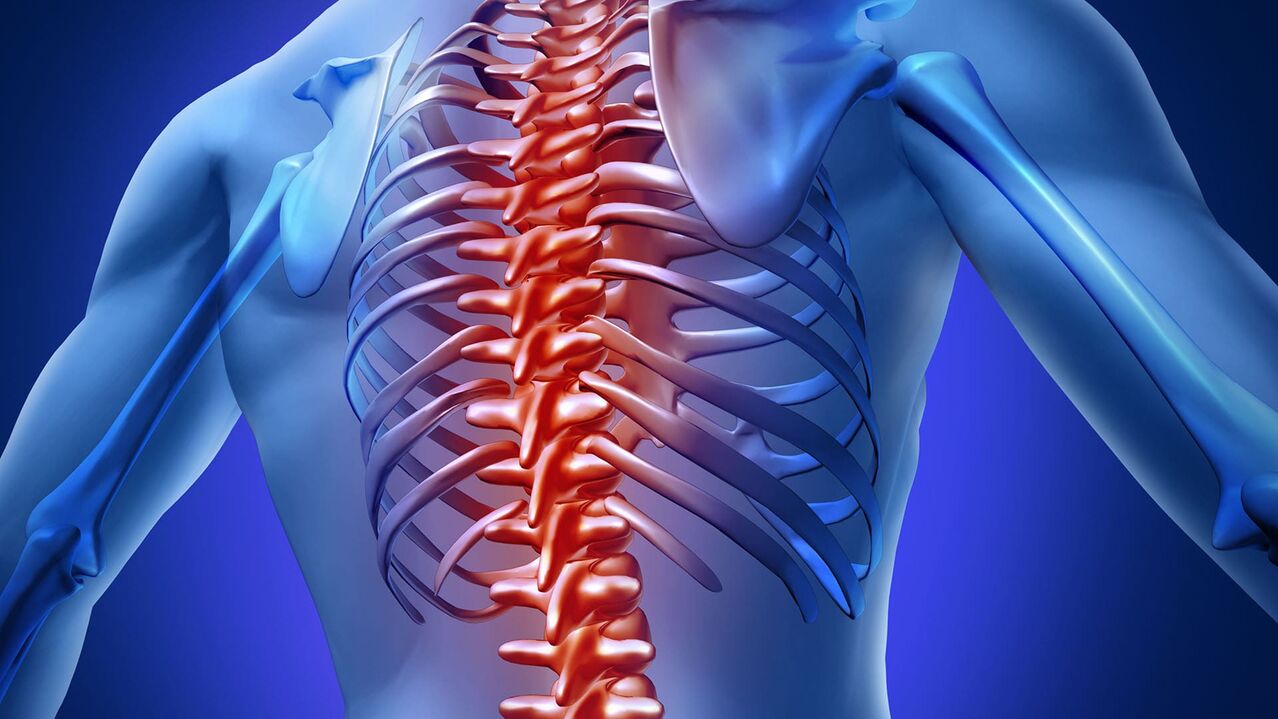 Osteocondrose torácica